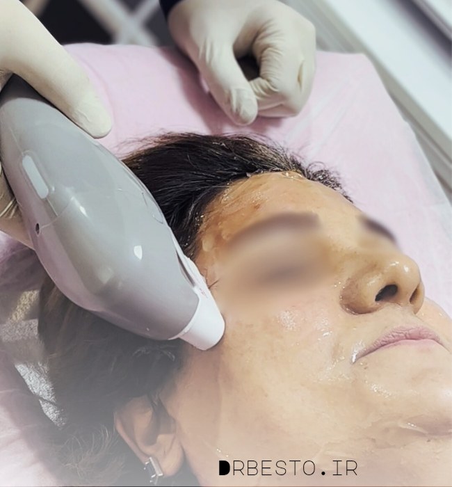 20250902_152533_2047531595