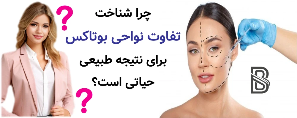 بوتاکس پیشانی، خط اخم و دور چشم ، چرا شناخت تفاوت نواحی بوتاکس برای نتیجه طبیعی حیاتی است؟