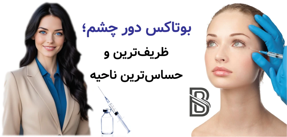 بوتاکس پیشانی، خط اخم و دور چشم، بوتاکس دور چشم؛ ظریفترین و حساسترین ناحیه