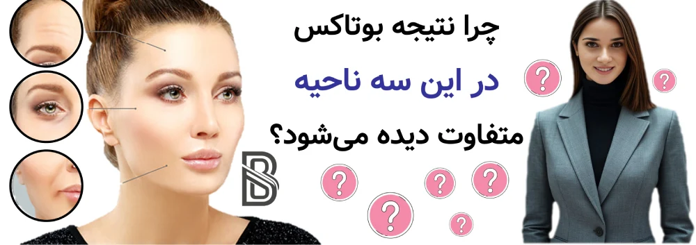 بوتاکس پیشانی، خط اخم و دور چشم، چرا نتیجه بوتاکس در این سه ناحیه متفاوت دیده میشود؟