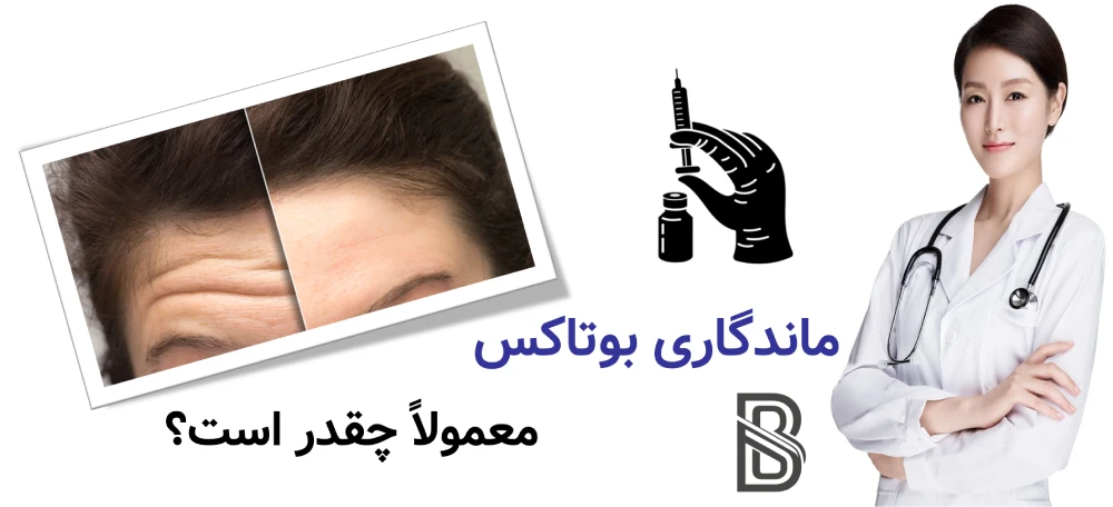 ماندگاری بوتاکس چقدر است و هر چند وقت تمدید میشود؟ ماندگاری بوتاکس معمولاً چقدر است؟