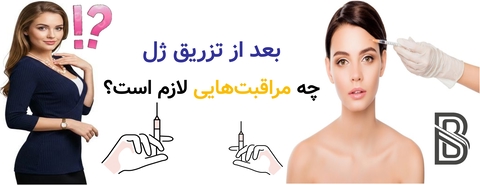 بعد از تزریق ژل چه مراقبت هایی لازم است؟