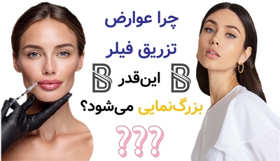چرا عوارض تزریق فیلر اینقدر بزرگنمایی میشود؟