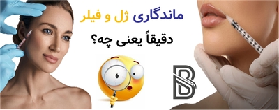 ماندگاری ژل و فیلر دقیقاً یعنی چه؟