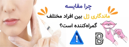 چرا مقایسه ماندگاری ژل بین افراد مختلف گمراهکننده است؟