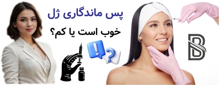 پس ماندگاری ژل خوب است یا کم؟