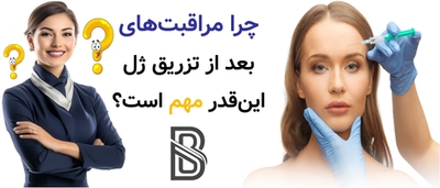 چرا مراقبتهای بعد از تزریق ژل اینقدر مهم است؟