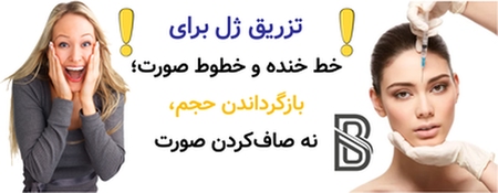 تزریق ژل برای خط خنده و خطوط صورت؛ بازگرداندن حجم، نه صافکردن صورت