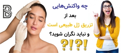 چه واکنشهایی بعد از تزریق ژل طبیعی است و نباید نگران شوید؟