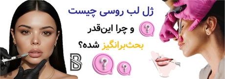 ژل لب روسی چیست و چرا اینقدر بحثبرانگیز شده؟