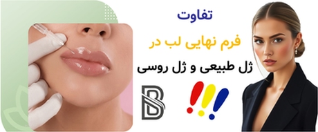 تفاوت فرم نهایی لب در ژل طبیعی و ژل روسی