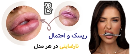 ریسک و احتمال نارضایتی در هر مدل