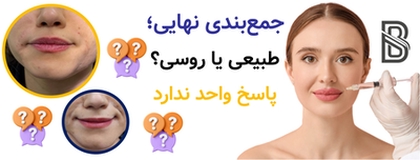 جمعبندی نهایی؛ طبیعی یا روسی؟ پاسخ واحد ندارد