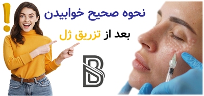 نحوه صحیح خوابیدن بعد از تزریق ژل