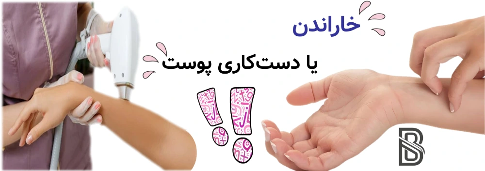 مراقبت های بعد از لیزر موهای زائد، چه کارهایی ممنوع است؟ خاراندن یا دستکاری پوست