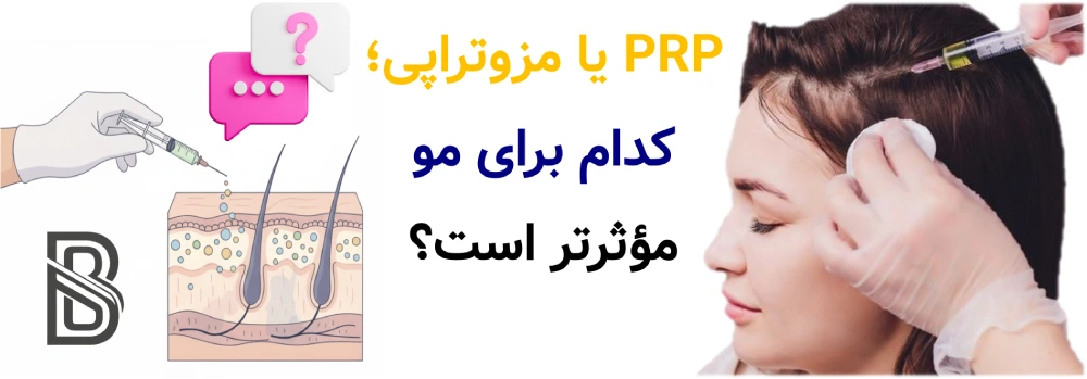 PRP بهتر است یا مزوتراپی؟ مقایسه علمی، PRP یا مزوتراپی؛ کدام برای مو مؤثرتر است؟