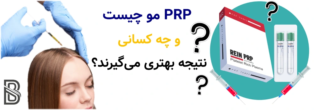 PRP مو چیست و چه کسانی نتیجه بهتری میگیرند؟