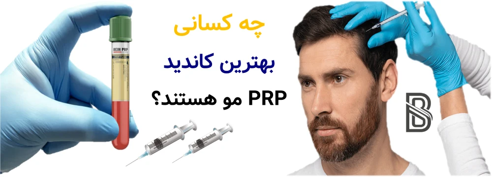 PRP مو چیست و چه کسانی نتیجه بهتری می گیرند؟ چه کسانی بهترین کاندید PRP مو هستند؟
