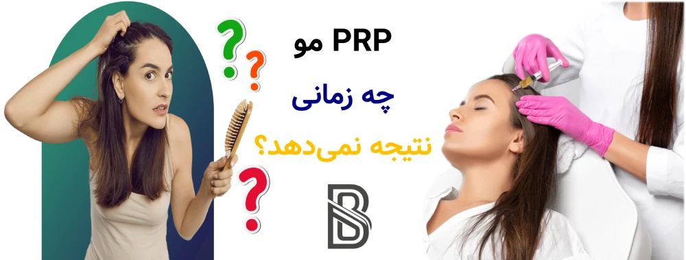 PRP مو چیست و چه کسانی نتیجه بهتری می گیرند؟ PRP مو چه زمانی نتیجه نمیدهد؟