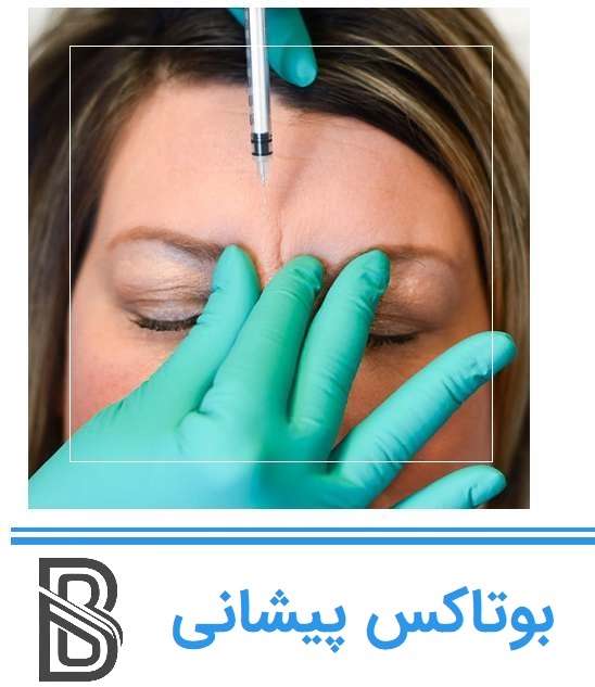 بوتاکس پیشانی