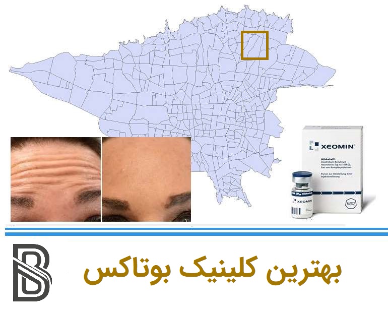 بهترین کلینیک بوتاکس در هروی