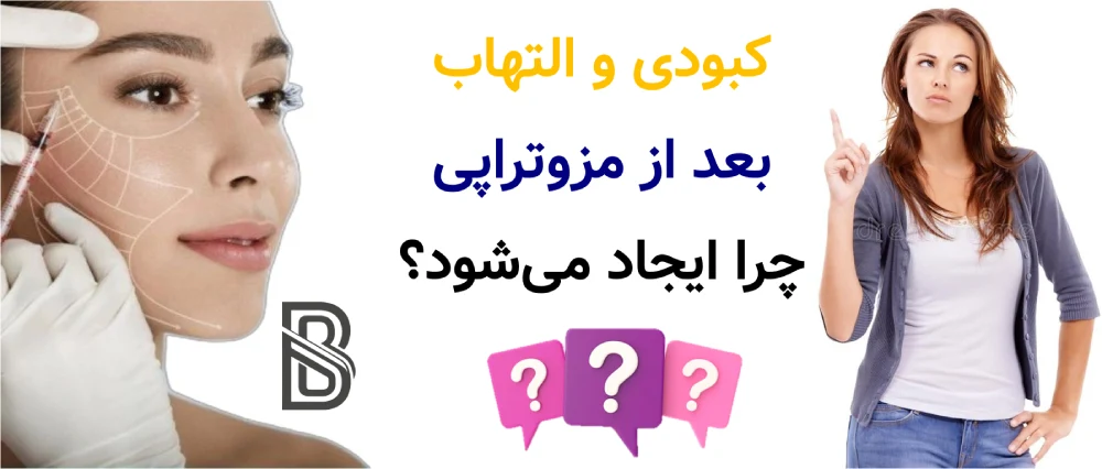 عوارض مزوتراپی و راه های پیشگیری، کبودی و التهاب بعد از مزوتراپی چرا ایجاد میشود؟