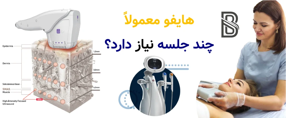ماندگاری هایفو چقدر است و چند جلسه نیاز دارد؟ هایفو معمولاً چند جلسه نیاز دارد؟