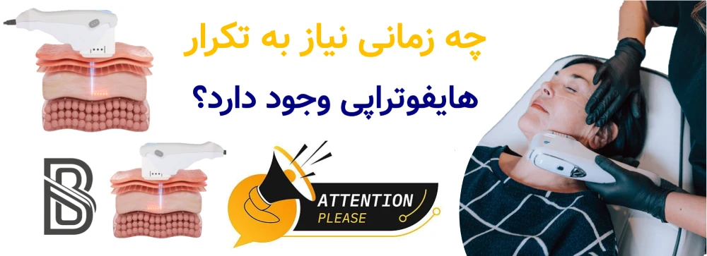 ماندگاری هایفو چقدر است و چند جلسه نیاز دارد؟ چه زمانی نیاز به تکرار هایفوتراپی وجود دارد؟
