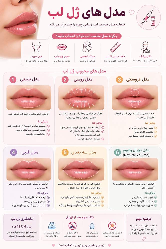 مدل های ژل لب