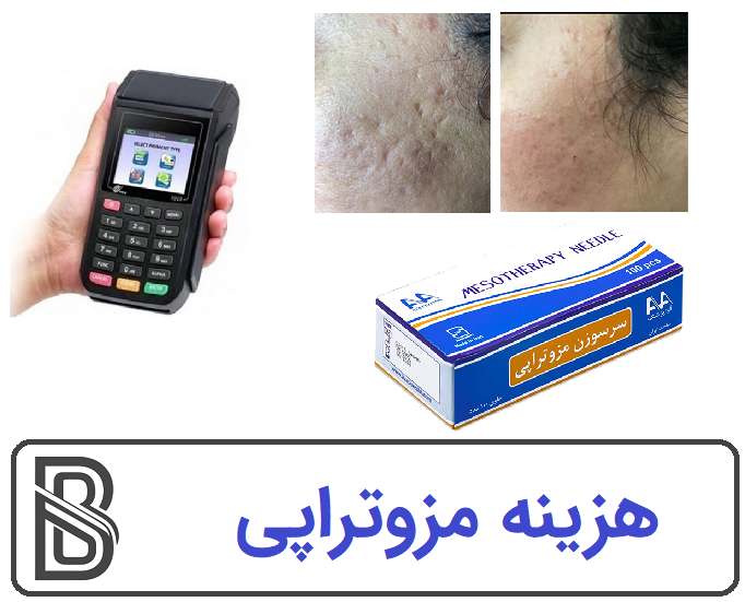 مزوتراپی صورت برای چه افرادی مناسبتر است؟