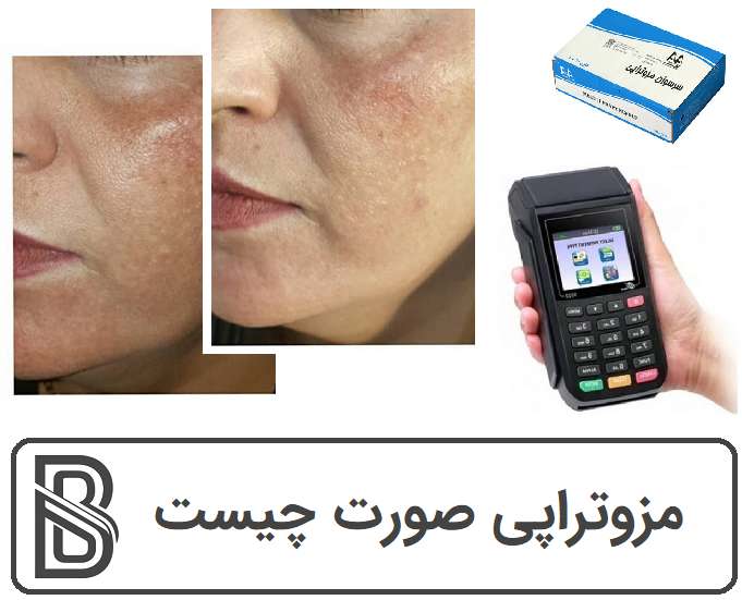 مزوتراپی صورت