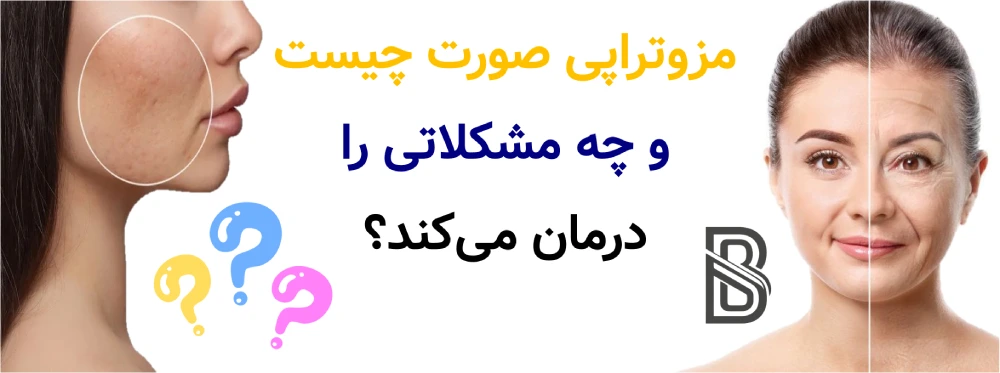مزوتراپی صورت چیست و چه مشکلاتی را درمان می کند؟