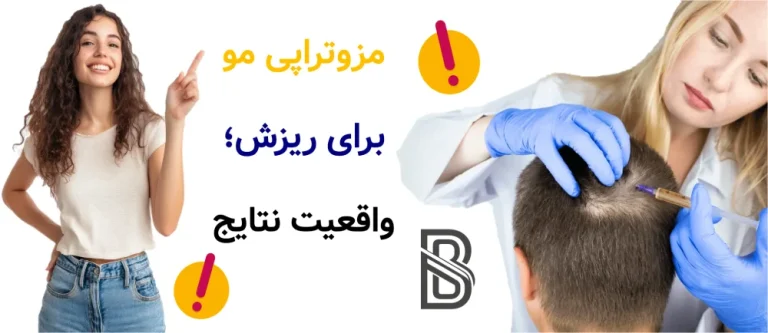 مزوتراپی مو برای ریزش، واقعیت نتایج