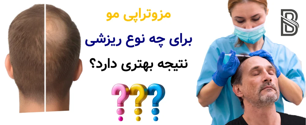 مزوتراپی مو برای ریزش، واقعیت نتایج. مزوتراپی مو برای چه نوع ریزشی نتیجه بهتری دارد؟
