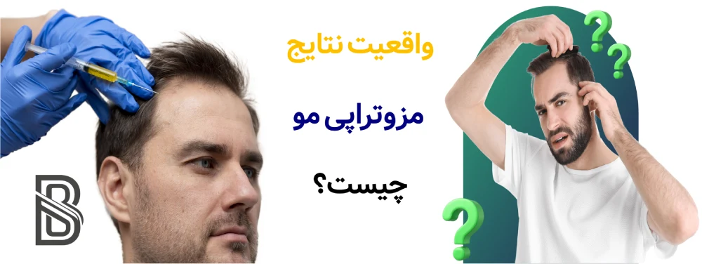 مزوتراپی مو برای ریزش، واقعیت نتایج. واقعیت نتایج مزوتراپی مو چیست؟