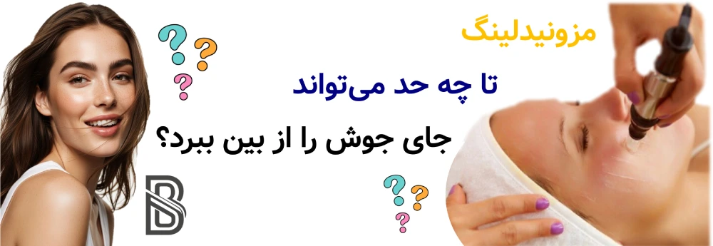 مزونیدلینگ برای جای جوش و لک، مزونیدلینگ تا چه حد میتواند جای جوش را از بین ببرد؟