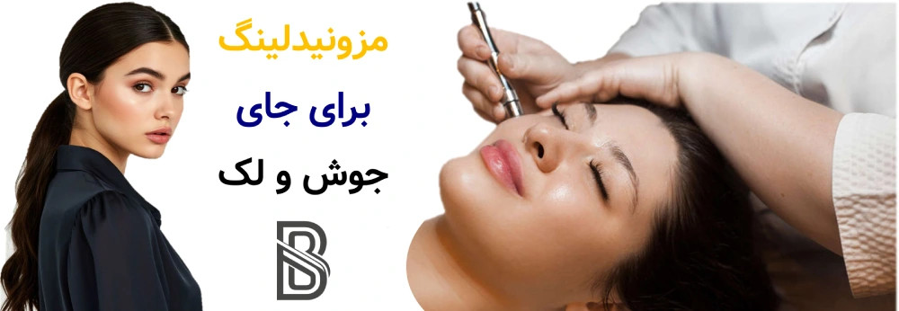 مزونیدلینگ برای جای جوش و لک