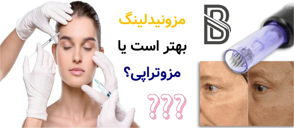 مزونیدلینگ بهتر است یا مزوتراپی؟