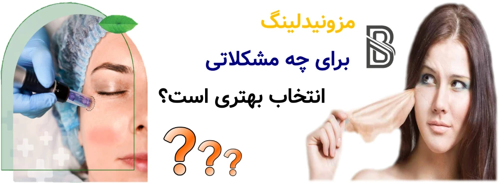 مزونیدلینگ بهتر است یا مزوتراپی؟ مزونیدلینگ برای چه مشکلاتی انتخاب بهتری است؟