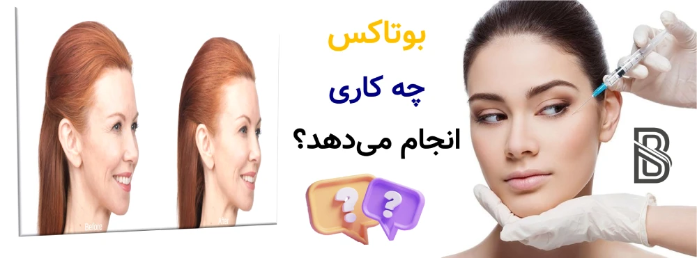 هایفو بهتر است یا بوتاکس و فیلر؟ بوتاکس چه کاری انجام میدهد؟