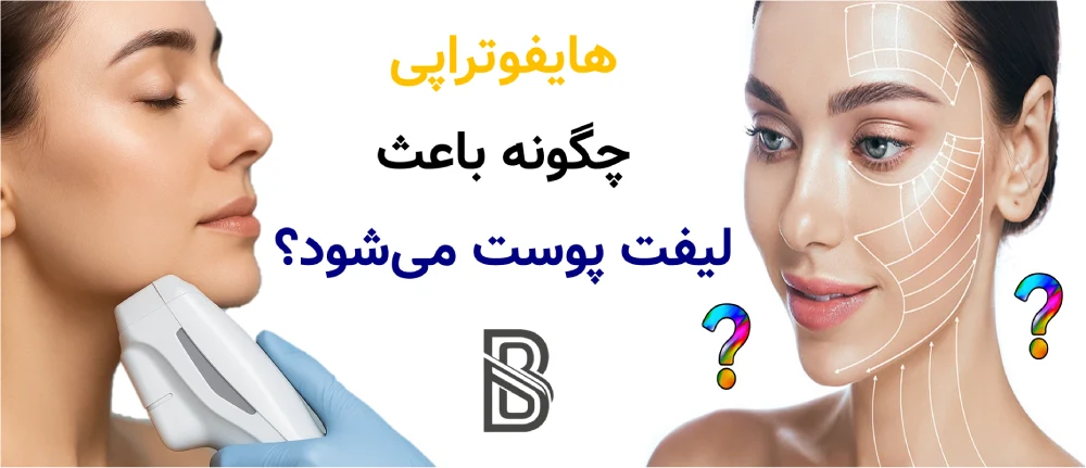 هایفوتراپی چیست و آیا واقعا لیفت می کند؟هایفوتراپی چگونه باعث لیفت پوست میشود؟