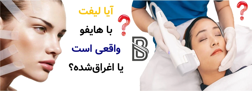هایفوتراپی چیست و آیا واقعا لیفت می کند؟آیا لیفت با هایفو واقعی است یا اغراقشده؟