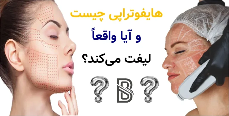 هایفوتراپی چیست و آیا واقعا لیفت می کند؟