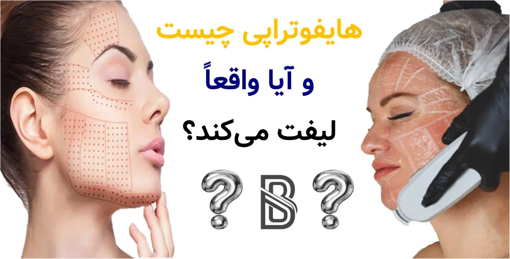 هایفوتراپی چیست و آیا واقعا لیفت می کند؟