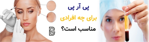 پی آر پی برای چه افرادی مناسب است؟