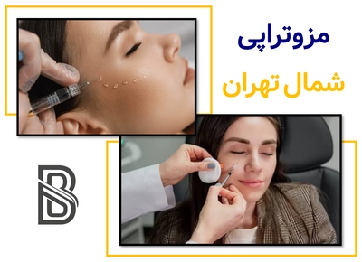 مزوتراپی شمال تهران