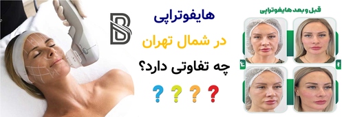 هایفوتراپی در شمال تهران چه تفاوتی دارد؟