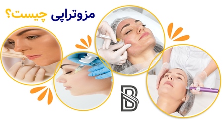 مزوتراپی چیست؟