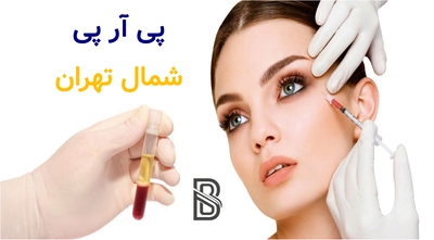 پی آر پی شمال تهران