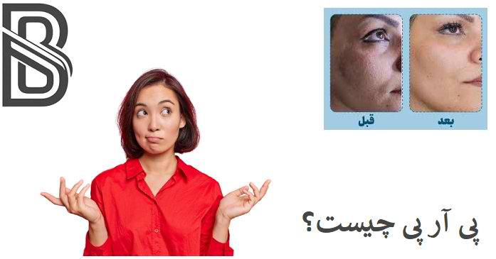 پی ار پی چیست ؟